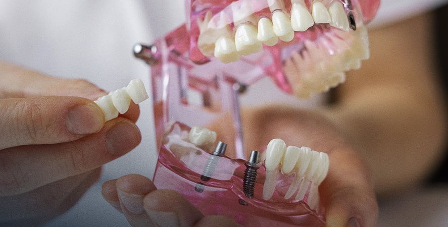 restorative dental services in florence, KY